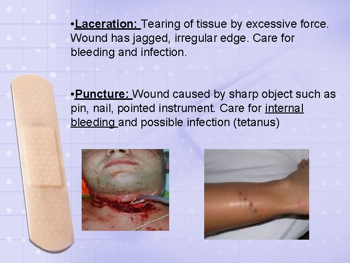  • Laceration: Tearing of tissue by excessive force. Wound has jagged, irregular edge.