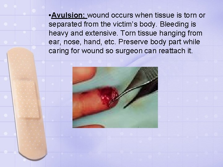  • Avulsion: wound occurs when tissue is torn or separated from the victim’s