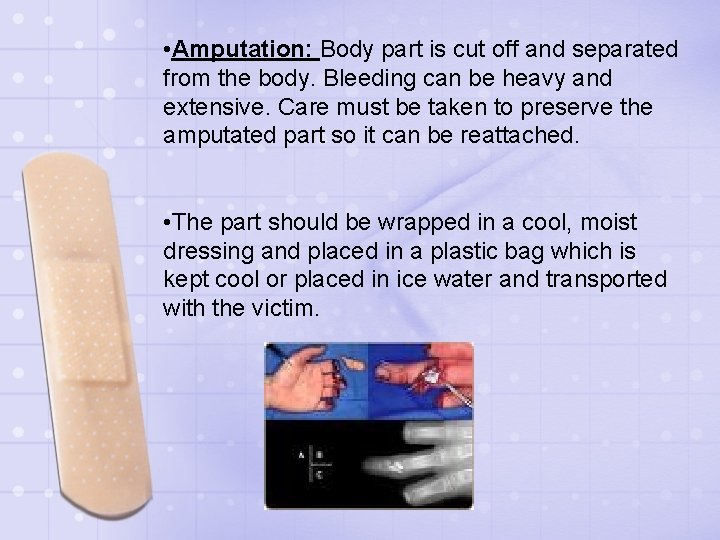  • Amputation: Body part is cut off and separated from the body. Bleeding