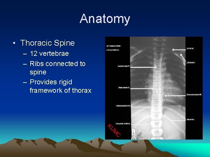 Anatomy • Thoracic Spine – 12 vertebrae – Ribs connected to spine – Provides