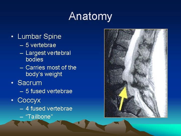 Anatomy • Lumbar Spine – 5 vertebrae – Largest vertebral bodies – Carries most