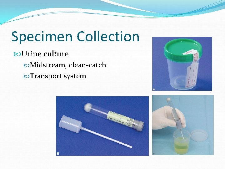 Specimen Collection Urine culture Midstream, clean-catch Transport system 