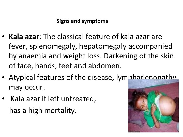 Signs and symptoms • Kala azar: The classical feature of kala azar are fever,