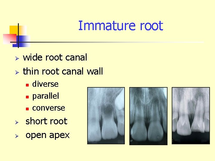 Immature root Ø Ø wide root canal thin root canal wall n n n