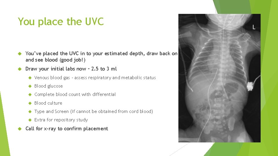 You place the UVC You’ve placed the UVC in to your estimated depth, draw