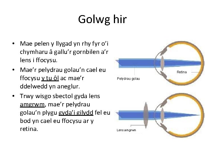 Golwg hir • Mae pelen y llygad yn rhy fyr o’i chymharu â gallu’r