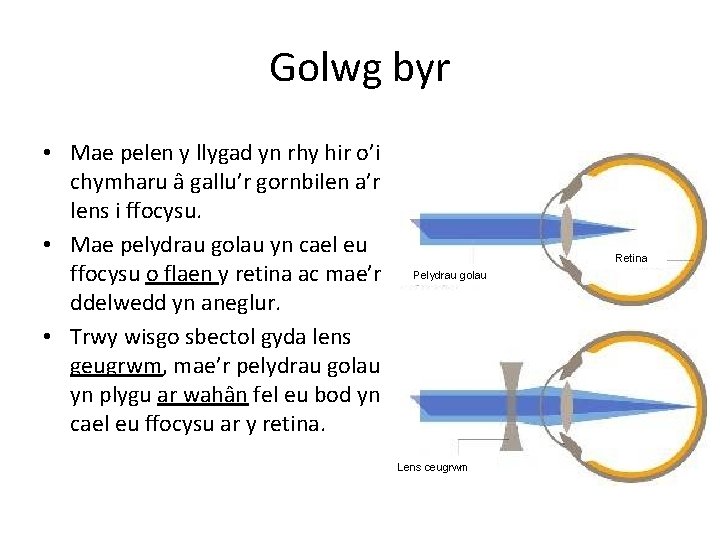 Golwg byr • Mae pelen y llygad yn rhy hir o’i chymharu â gallu’r