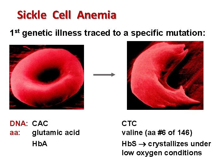 Sickle Cell Anemia 1 st genetic illness traced to a specific mutation: DNA: CAC
