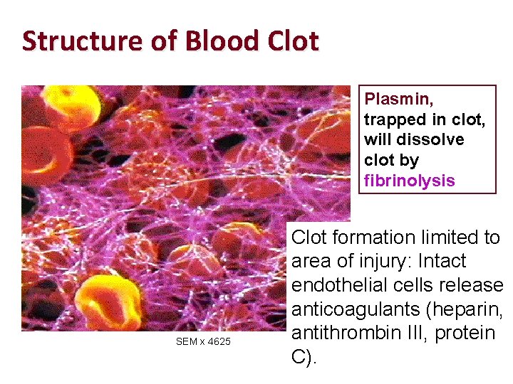 Structure of Blood Clot Plasmin, trapped in clot, will dissolve clot by fibrinolysis SEM