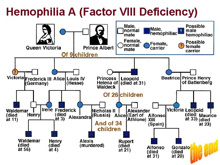 Hemophilia A (Factor VIII Deficiency) 