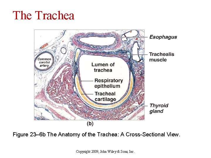 The Trachea Figure 23– 6 b The Anatomy of the Trachea: A Cross-Sectional View.