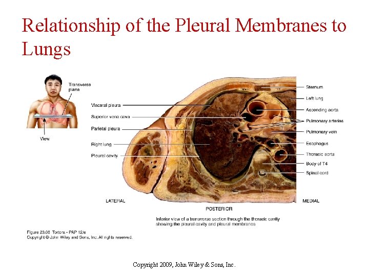 Relationship of the Pleural Membranes to Lungs Copyright 2009, John Wiley & Sons, Inc.