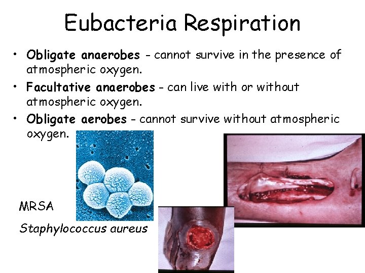 Eubacteria Respiration • Obligate anaerobes - cannot survive in the presence of atmospheric oxygen.