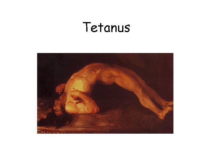 Tetanus 