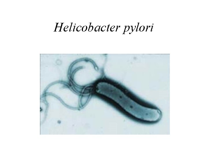 Helicobacter pylori 