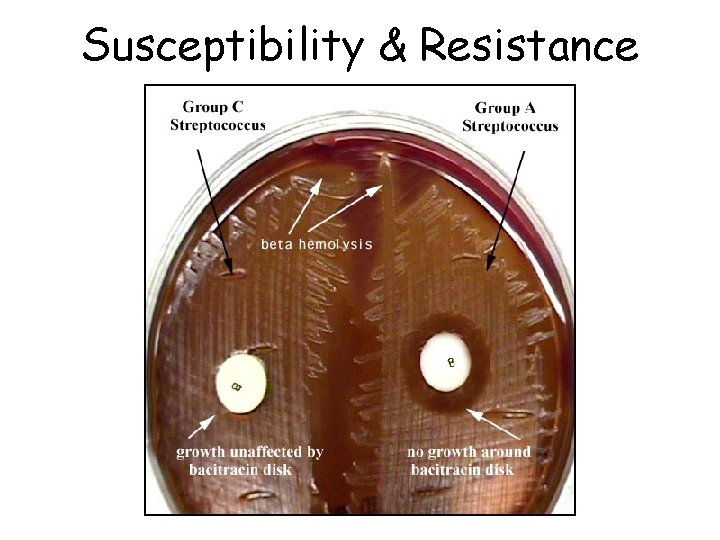 Susceptibility & Resistance 