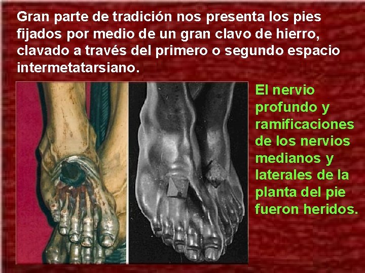 Gran parte de tradición nos presenta los pies fijados por medio de un gran