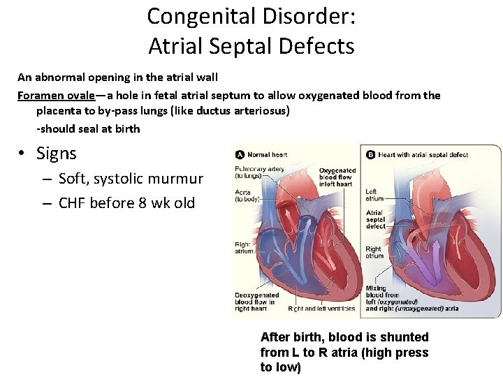 Congenital Disorder: Atrial Septal Defects An abnormal opening in the atrial wall Foramen ovale—a