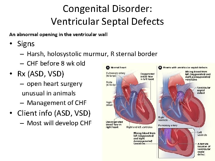 Congenital Disorder: Ventricular Septal Defects An abnormal opening in the ventricular wall • Signs