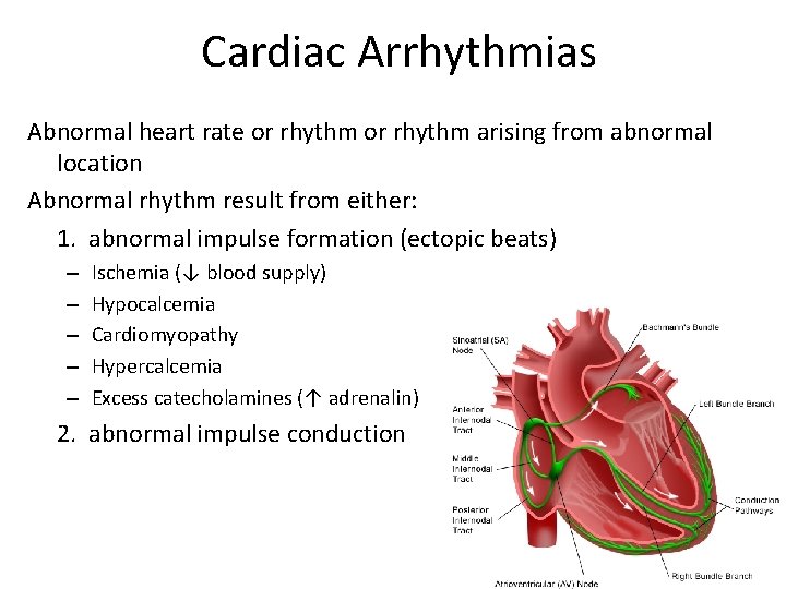 Cardiac Arrhythmias Abnormal heart rate or rhythm arising from abnormal location Abnormal rhythm result