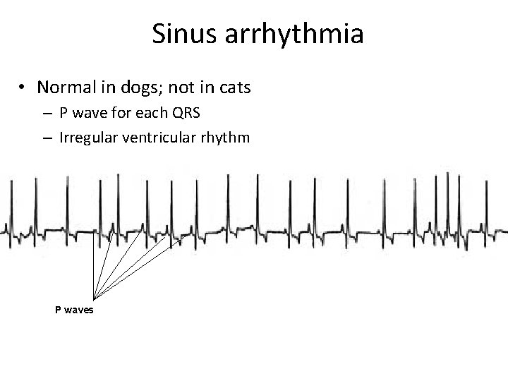 Sinus arrhythmia • Normal in dogs; not in cats – P wave for each