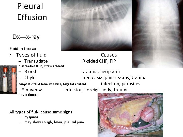 Pleural Effusion Dx—x-ray Fluid in thorax • Types of fluid – Transudate plasma-like fluid;