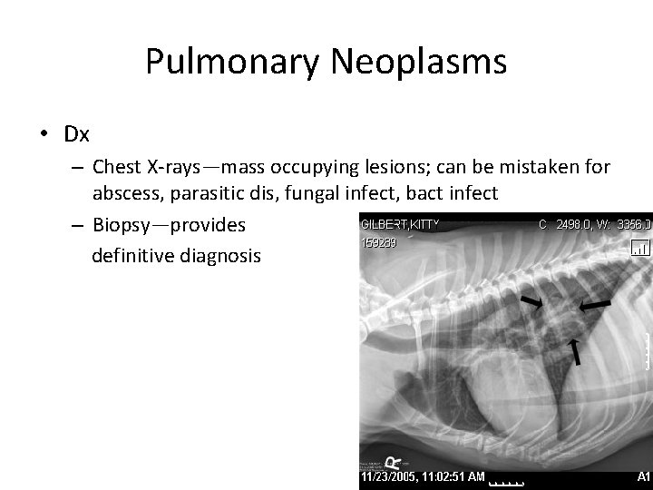 Pulmonary Neoplasms • Dx – Chest X-rays—mass occupying lesions; can be mistaken for abscess,