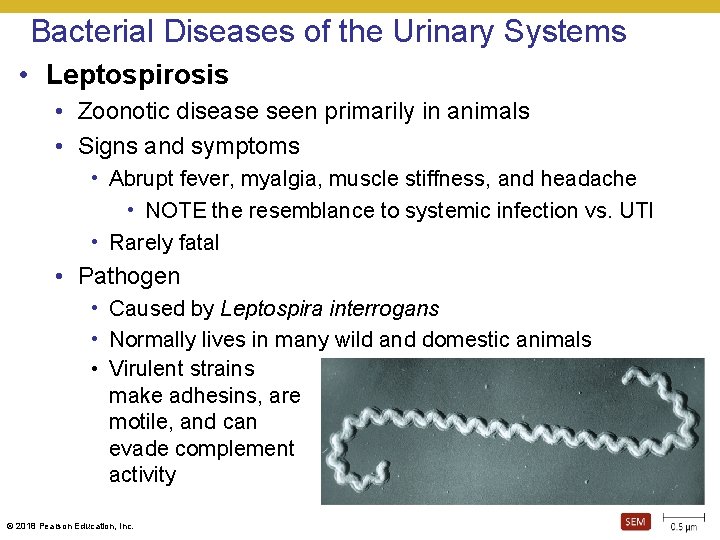 Bacterial Diseases of the Urinary Systems • Leptospirosis • Zoonotic disease seen primarily in