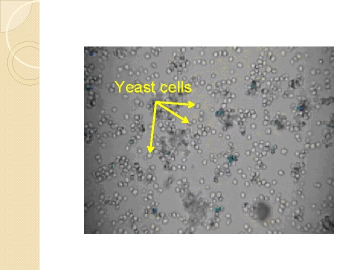 Yeast cells 