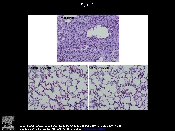 Figure 2 The Journal of Thoracic and Cardiovascular Surgery 2016 151841 -849 DOI: (10.