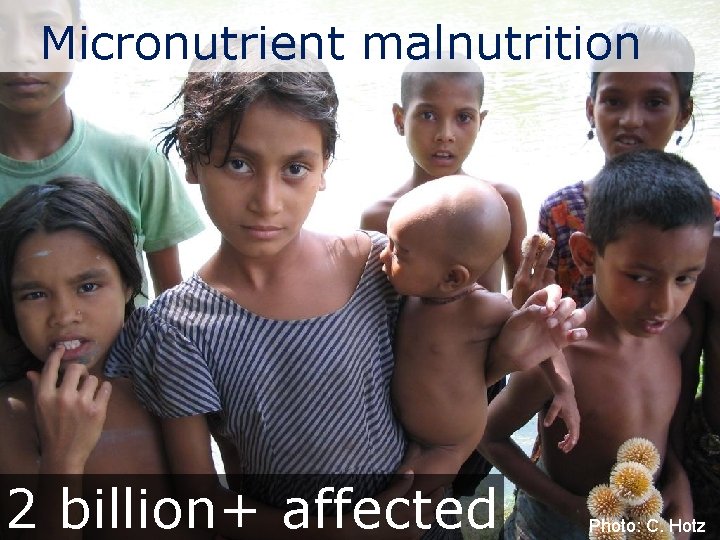 Micronutrient malnutrition 2 billion+ affected Photo: C. Hotz 