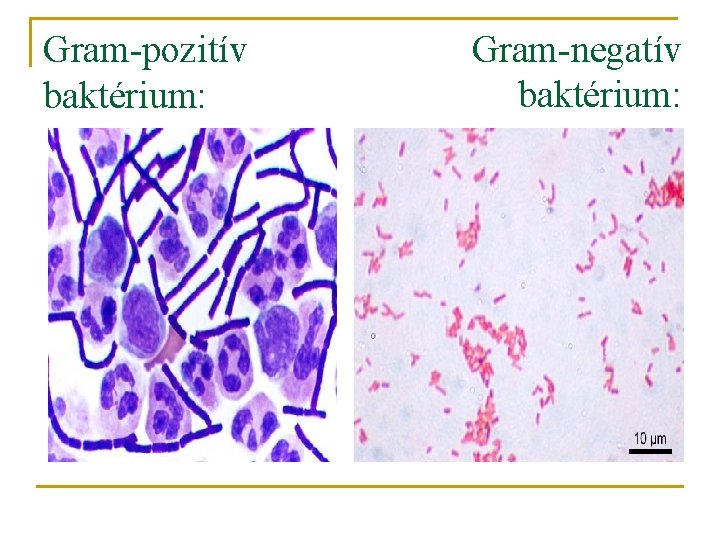 Gram-pozitív baktérium: Gram-negatív baktérium: 