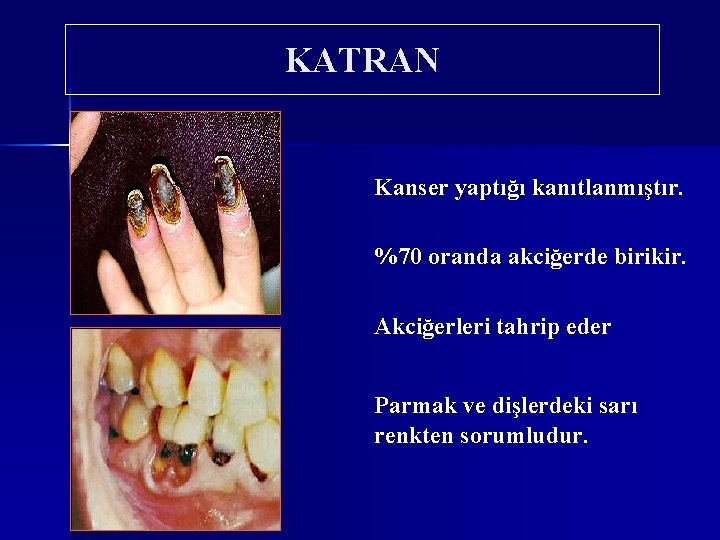 KATRAN Kanser yaptığı kanıtlanmıştır. %70 oranda akciğerde birikir. Akciğerleri tahrip eder Parmak ve dişlerdeki