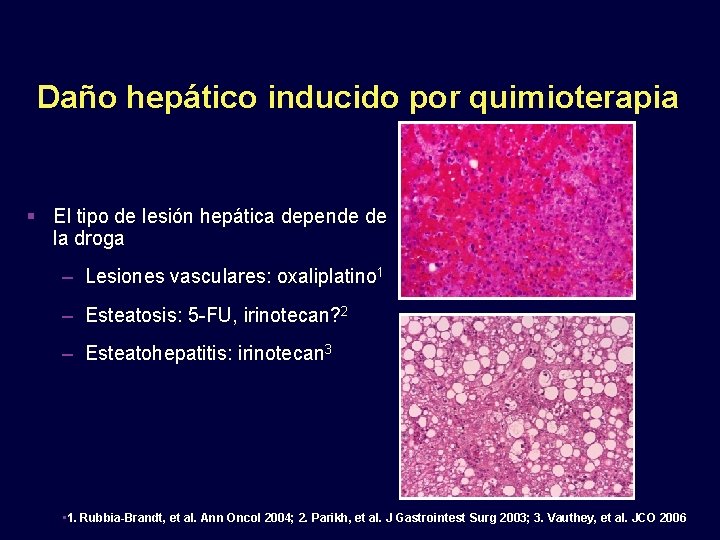 Daño hepático inducido por quimioterapia El tipo de lesión hepática depende de la droga