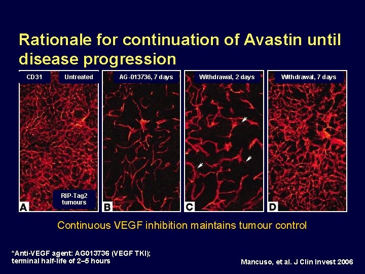 Rationale for continuation of Avastin until disease progression CD 31 Untreated AG-013736, 7 days