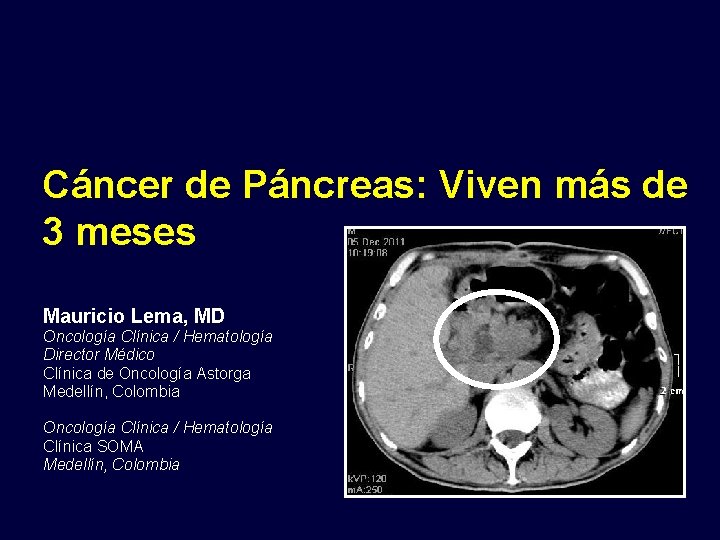 Cáncer de Páncreas: Viven más de 3 meses Mauricio Lema, MD Oncología Clínica /