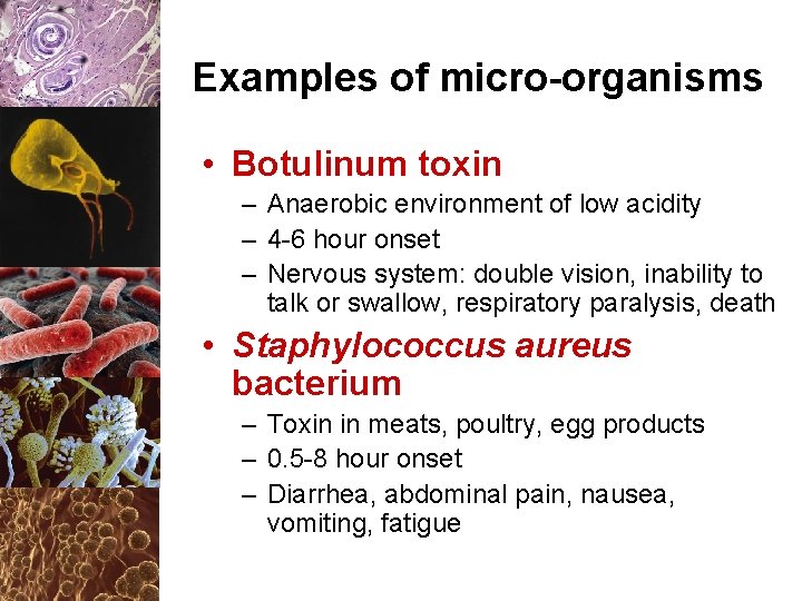 Examples of micro-organisms • Botulinum toxin – Anaerobic environment of low acidity – 4
