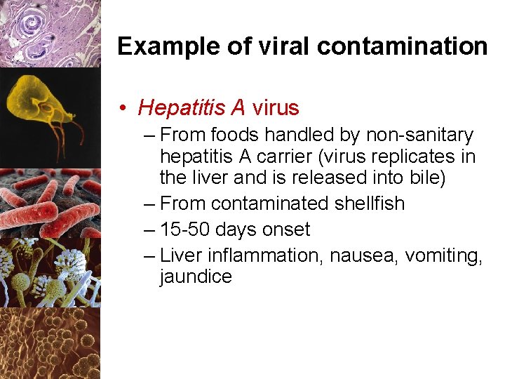 Example of viral contamination • Hepatitis A virus – From foods handled by non-sanitary