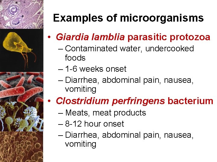 Examples of microorganisms • Giardia lamblia parasitic protozoa – Contaminated water, undercooked foods –