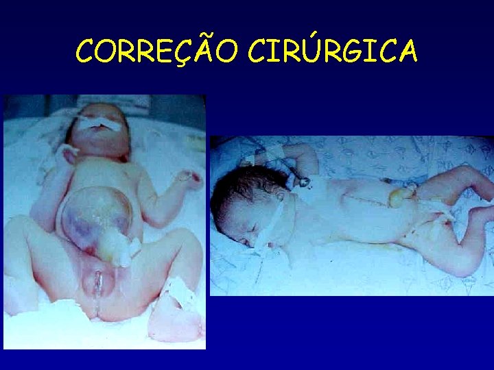 CORREÇÃO CIRÚRGICA 