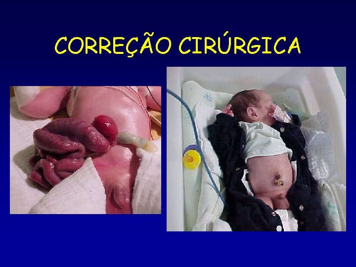 CORREÇÃO CIRÚRGICA 