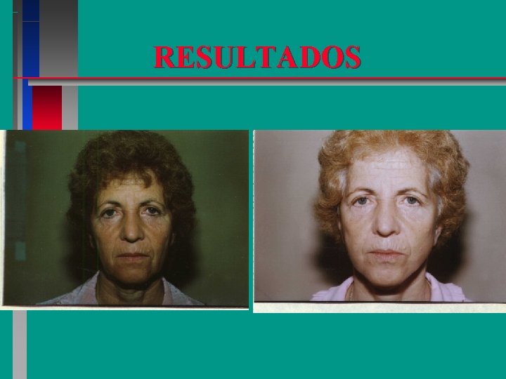 RESULTADOS 