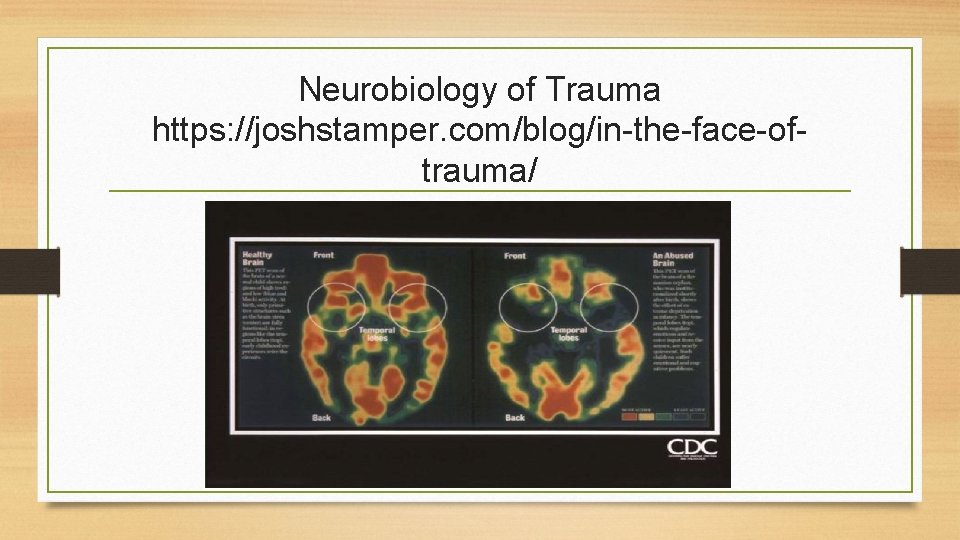Neurobiology of Trauma https: //joshstamper. com/blog/in-the-face-oftrauma/ 