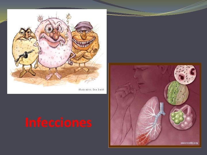 Infecciones 