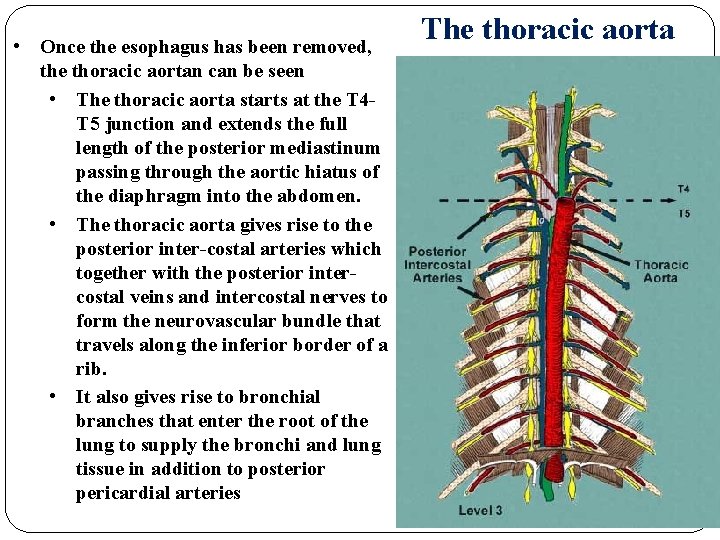  • Once the esophagus has been removed, the thoracic aortan can be seen