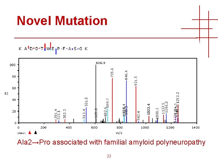 Novel Mutation Ala 2→Pro associated with familial amyloid polyneuropathy 22 