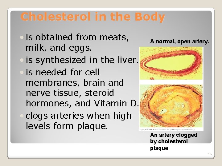 Cholesterol in the Body • is obtained from meats, milk, and eggs. • is