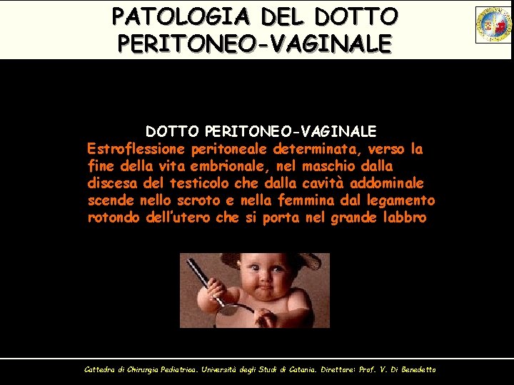 PATOLOGIA DEL DOTTO PERITONEO-VAGINALE Estroflessione peritoneale determinata, verso la fine della vita embrionale, nel