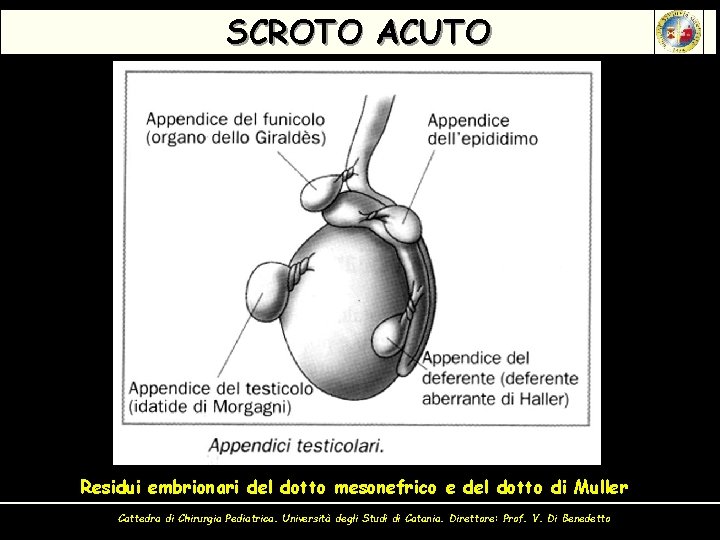 SCROTO ACUTO Residui embrionari del dotto mesonefrico e del dotto di Muller Cattedra di