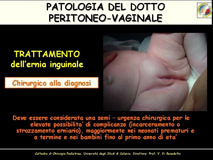 PATOLOGIA DEL DOTTO PERITONEO-VAGINALE TRATTAMENTO dell’ernia inguinale Chirurgico alla diagnosi Deve essere considerata una